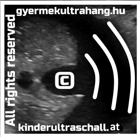 copyright