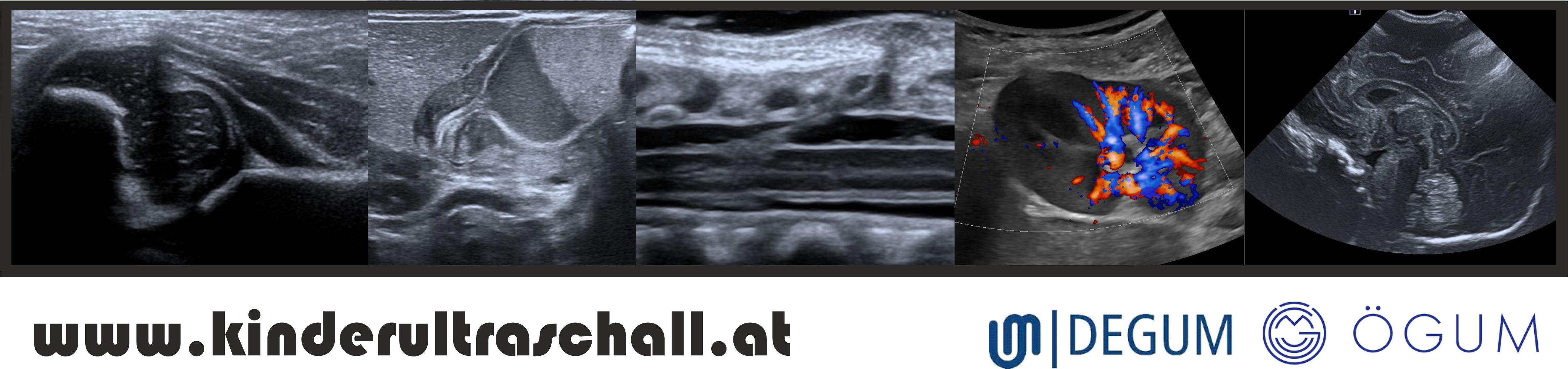 Kinderultraschall - Anwendung des Ultraschalls in der pädiatrischen Diagnostik